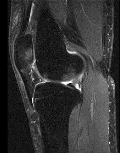 Rodilla